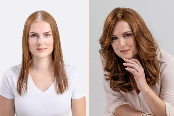 Beispiel 04 Oberkopfverdichtung mit Microlines-System